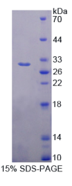 双肾上腺皮质激素样激酶1(DCLK1)重组蛋白