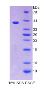 分泌球蛋白家族3A成员1(SCGB3A1)重组蛋白