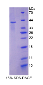角蛋白2(KRT2)重组蛋白