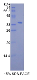 视黄醇结合蛋白3(RBP3)重组蛋白