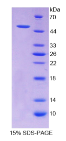 醛脱氢酶1家族成员A2(ALDH1A2)重组蛋白