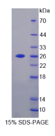 钙黏蛋白23(CDH23)重组蛋白