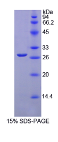 谷胱甘肽S转移酶μ1(GSTμ1)重组蛋白