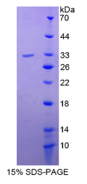 整合素α1(ITGα1)重组蛋白