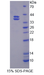 钙粘蛋白EGF LAG七经G-型受体2(CELSR2)重组蛋白