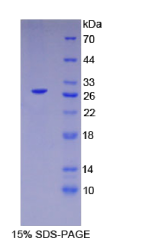 肝细胞核因子4α(HNF4α)重组蛋白