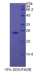 胰岛素样生长因子结合蛋白7(IGFBP7)重组蛋白
