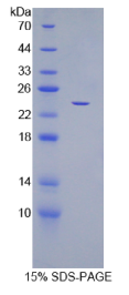 细胞分裂周期因子25B(CDC25B)重组蛋白