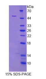 异柠檬酸脱氢酶2(IDH2)重组蛋白