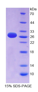 肝配蛋白A3(EFNA3)重组蛋白