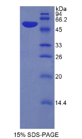激肽释放酶6(KLK6)重组蛋白