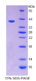 角蛋白14(KRT14)重组蛋白