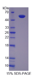 含TCP1伴侣蛋白亚基2(CCT2)重组蛋白