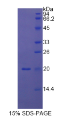 胱天蛋白酶8(CASP8)重组蛋白