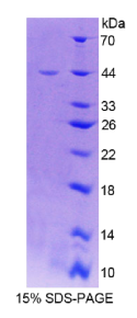 肌微管钙黏附蛋白(CDH15)重组蛋白