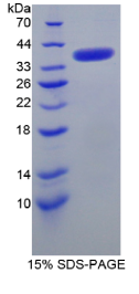 运动神经元生存蛋白1(SMN1)重组蛋白