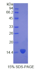 角蛋白2(KRT2)重组蛋白