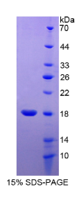 含RCC1和BTB域蛋白2(RCBTB2)重组蛋白