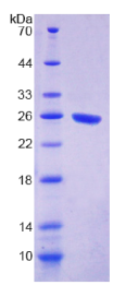 信号调节蛋白α(SIRPα)重组蛋白