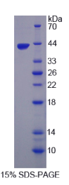 原肌球调节蛋白3(TMOD3)重组蛋白