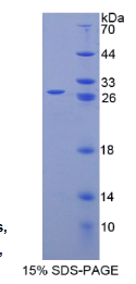 精子蛋白17(Sp17)重组蛋白