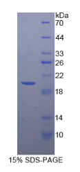 集落刺激因子2受体α(CSF2Rα)重组蛋白