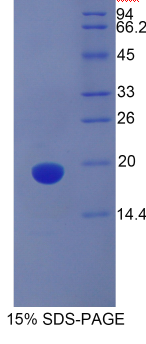 血小板膜糖蛋白Ⅵ(GP6)重组蛋白