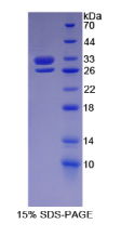 基底细胞粘附分子(BCAM)重组蛋白