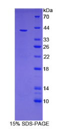 含V-Set域T细胞激活抑制因子1(VTCN1)重组蛋白