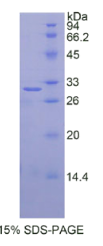 胰岛素样生长因子2-mRNA结合蛋白2(IGF2BP2)重组蛋白