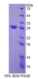 卷曲同源物1(FZD1)重组蛋白