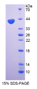 巨噬细胞炎性蛋白1β(MIP1β)重组蛋白