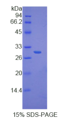 核因子κB抑制因子δ(IκBδ)重组蛋白