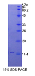 分泌型Ly6/uPAR相关蛋白1(SLURP1)重组蛋白