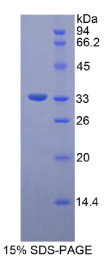 整合素β3(ITGβ3)重组蛋白