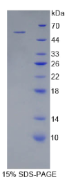 激肽释放酶6(KLK6)重组蛋白