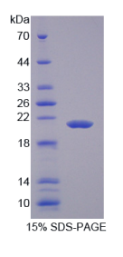 胰岛素样生长因子2(IGF2)重组蛋白