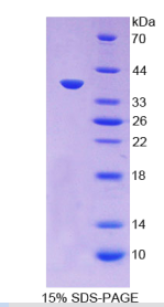 巨噬细胞炎性蛋白1α(MIP1α)重组蛋白