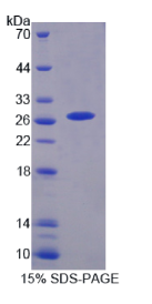 烟碱型胆碱受体α3(CHRNα3)重组蛋白