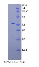 整合素β4(ITGβ4)重组蛋白