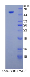 微管蛋白β3(TUBβ3)重组蛋白