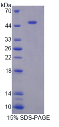 胃动蛋白1(GKN1)重组蛋白