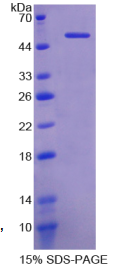 可罗索(KL)重组蛋白