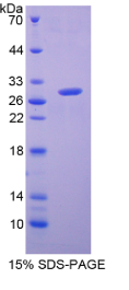 谷胱甘肽S转移酶α2(GSTα2)重组蛋白