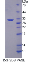 透明质酸结合蛋白1(HABP1)重组蛋白