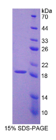 原钙黏素20(PCDH20)重组蛋白