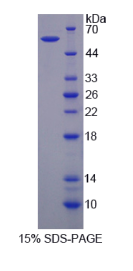 分拣蛋白1(SORT1)重组蛋白