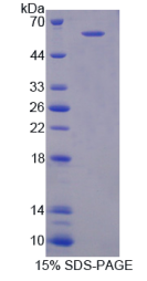 免疫球蛋白超家族成员2(IGSF2)重组蛋白