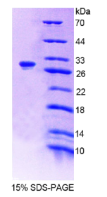 线粒体G延伸因子1(GFM1)重组蛋白
