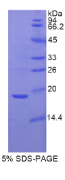 胃动蛋白1(GKN1)重组蛋白